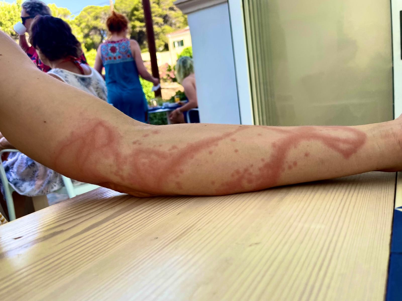 When travel doesn’t go to plan